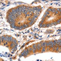 兔抗MYH7多克隆抗体