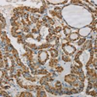 兔抗SDHB多克隆抗体