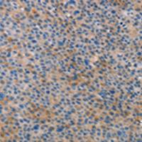 兔抗ALOX15B多克隆抗体