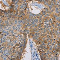 兔抗CDCP1多克隆抗体