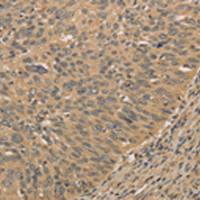 兔抗PRDM14多克隆抗体