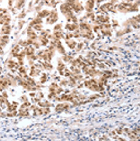 兔抗CTBP2多克隆抗体
