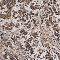 兔抗TLL1多克隆抗体