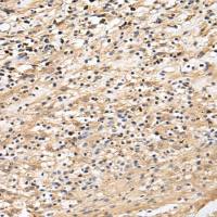 兔抗CRACR2A多克隆抗体