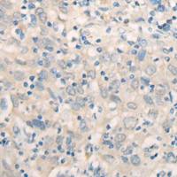 兔抗FSD1多克隆抗体