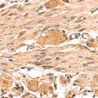 兔抗UQCRH多克隆抗体