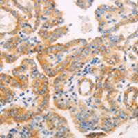 兔抗SUFU多克隆抗体