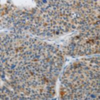 兔抗ATG4A多克隆抗体