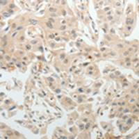 兔抗ABCB11多克隆抗体