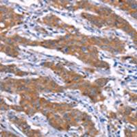 兔抗SGK2多克隆抗体