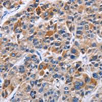 兔抗ENPP5多克隆抗体