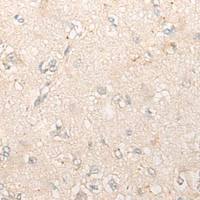 兔抗DDA1多克隆抗体