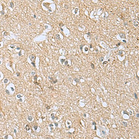 兔抗APOBR多克隆抗体