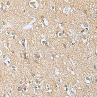 兔抗APOBR多克隆抗体