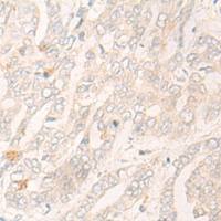 兔抗CYP2C19多克隆抗体