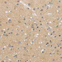 兔抗MPP6多克隆抗体