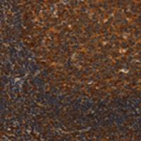 兔抗MIP多克隆抗体