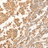 兔抗NAP1L1多克隆抗体