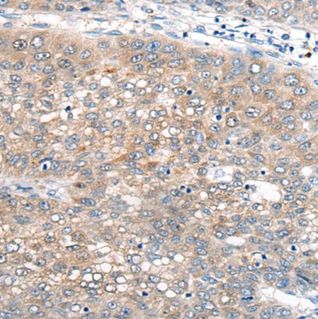 兔抗UBE2G2多克隆抗体