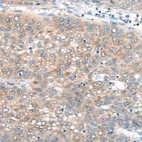 兔抗UBE2G2多克隆抗体