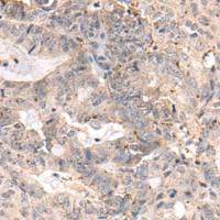 兔抗MEDAG多克隆抗体