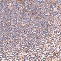 兔抗PDRG1多克隆抗体