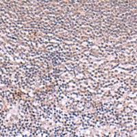 兔抗IRX6多克隆抗体