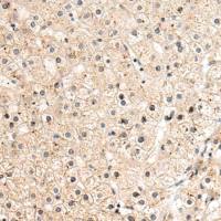 兔抗SPTLC2多克隆抗体