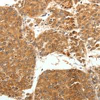 兔抗SOCS3多克隆抗体