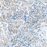 兔抗CPLX1多克隆抗体