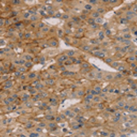 兔抗TM4SF1多克隆抗体