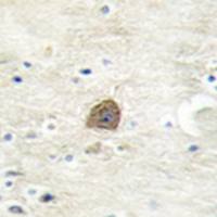 兔抗CAMK2B/CAMK2D(Phospho-Thr305)多克隆抗体