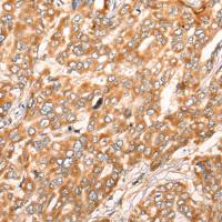 兔抗ZMYND10多克隆抗体