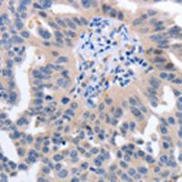 兔抗YWHAQ多克隆抗体