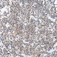 兔抗ARL5A多克隆抗体