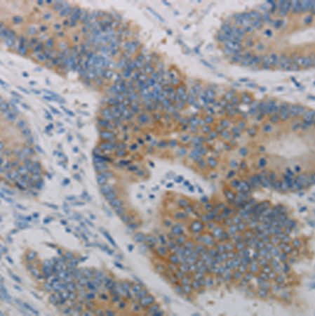 兔抗CLEC4C多克隆抗体