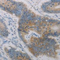 兔抗CLEC4C多克隆抗体