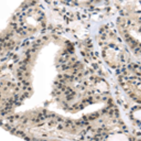 兔抗TRARG1多克隆抗体