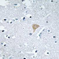 兔抗CIT多克隆抗体