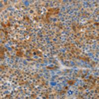 兔抗HTRA3多克隆抗体