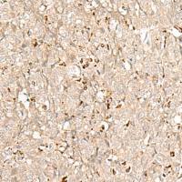 兔抗NUP210多克隆抗体