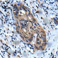 兔抗UBR2多克隆抗体