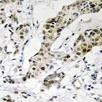 兔抗TCEAL3多克隆抗体