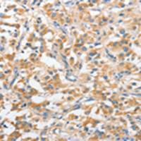 兔抗ANKMY2多克隆抗体