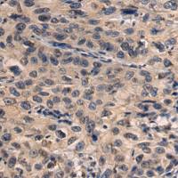 兔抗CIDEC多克隆抗体