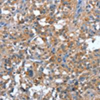 兔抗PLA2G6多克隆抗体