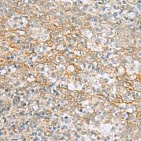 兔抗KCNH7多克隆抗体