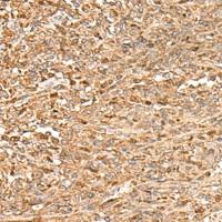 兔抗ZC3H7A多克隆抗体