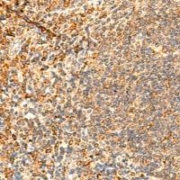 兔抗PPM1B多克隆抗体