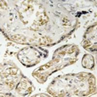 兔抗APOBEC3D/F多克隆抗体